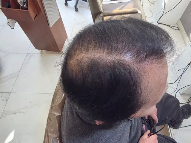 아이린헤어 사진 2