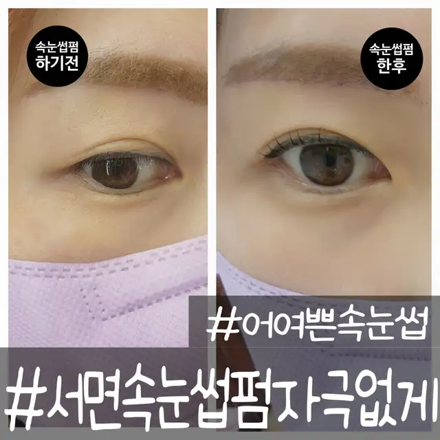 어여쁜속눈썹 사진 3