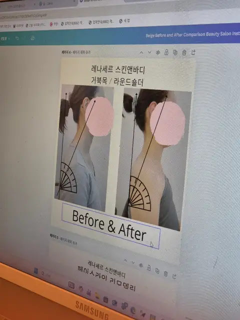 레나세르 스킨앤바디 사진 3