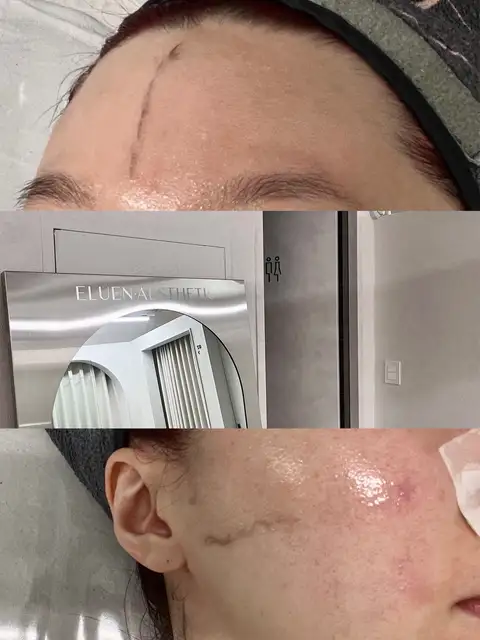 엘루엔에스테틱 홍대점 사진 7