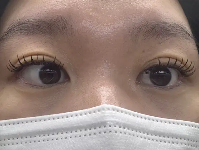 이유 사진 4