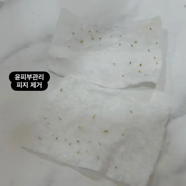 윤피부관리 사진 3