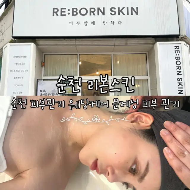 리본스킨 사진 5