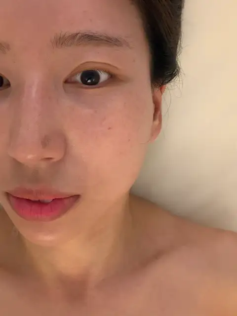 카리스에스테틱 사진 2