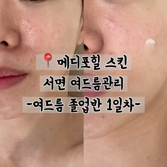 메디포힐스킨 사진 5