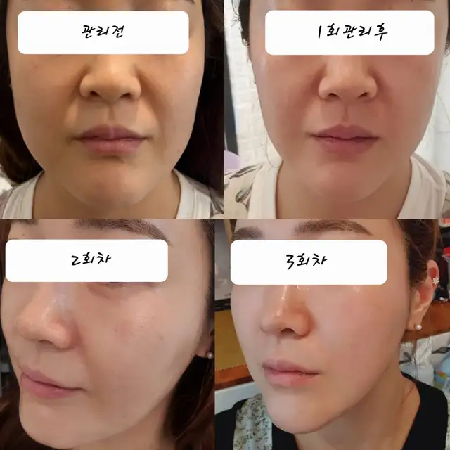 라라스킨 사진 3