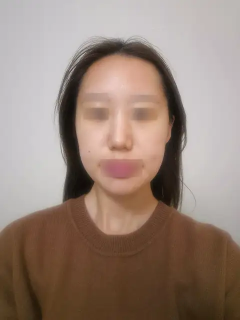 델라에스테틱 사진 4