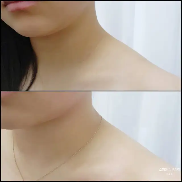 블로우숨 사진 6