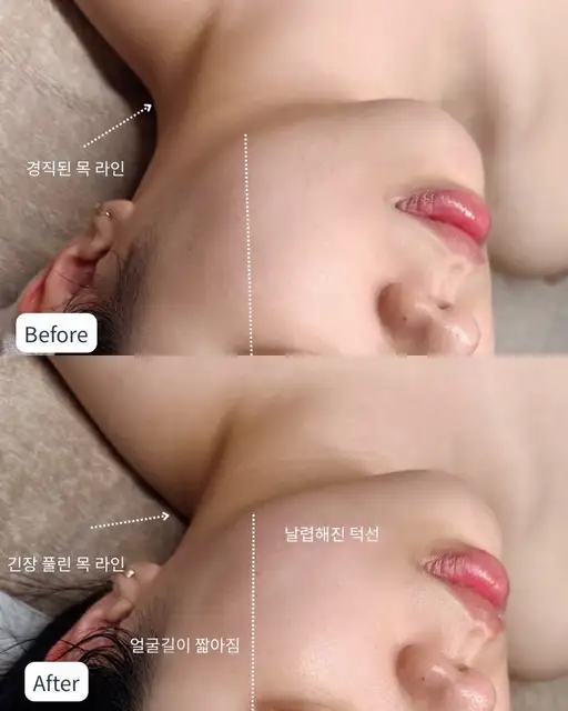 트루에스테틱 사진 4