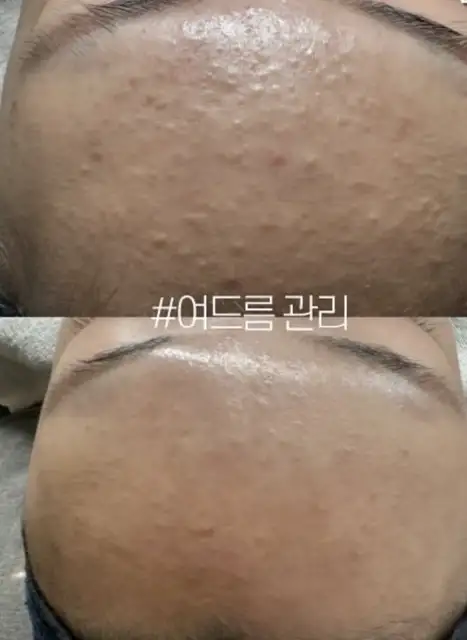 미올림 사진 7