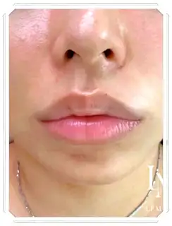 카라케어 사진