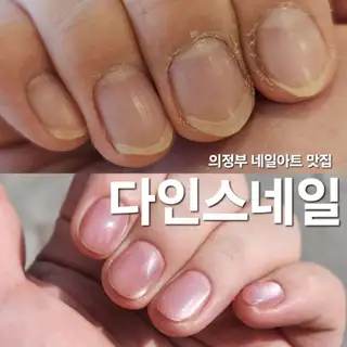 다인스네일 사진