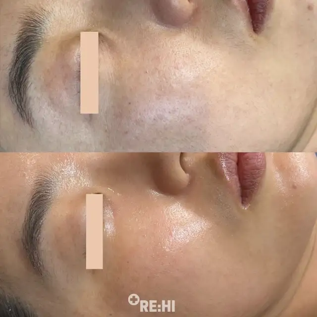 리하이 피부전문센터 사진 2