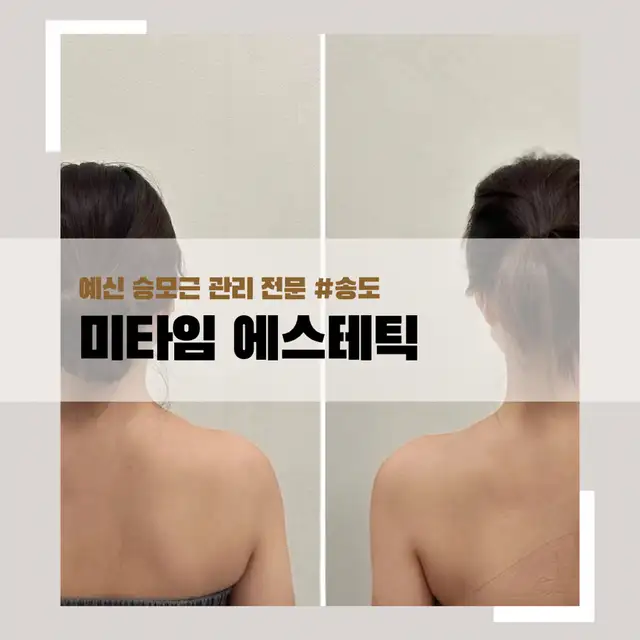 미타임에스테틱 사진 3