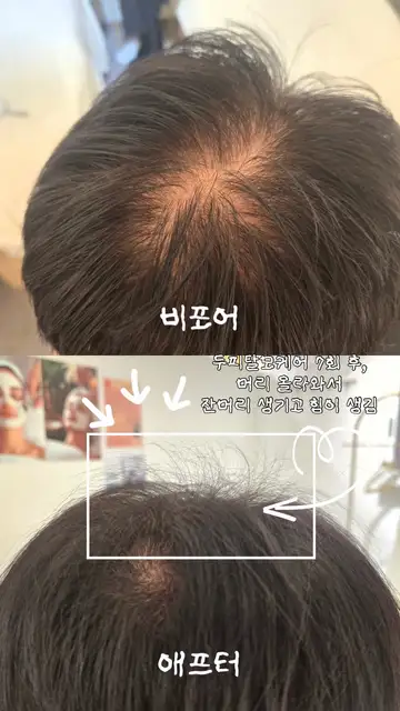 오렌지브로우 사진 5