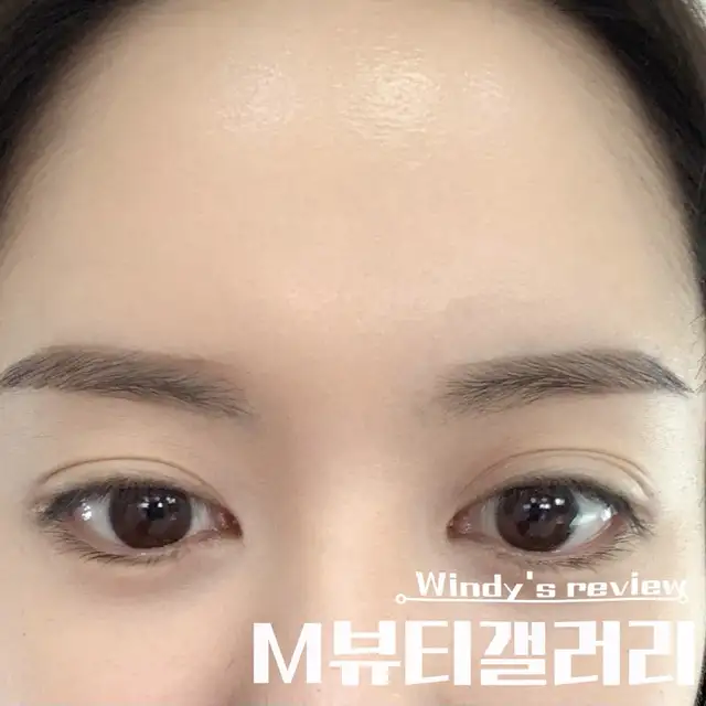 M뷰티갤러리 사진 5