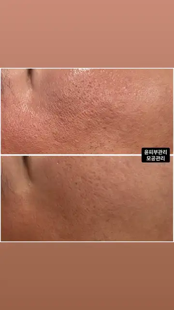 윤피부관리 사진 4