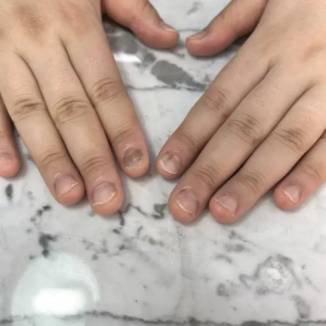 공감네일 사진 2