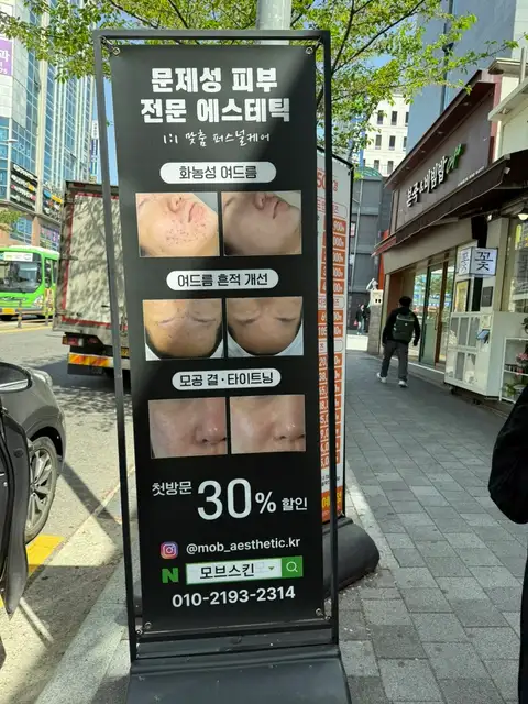 모브스킨 사진 2