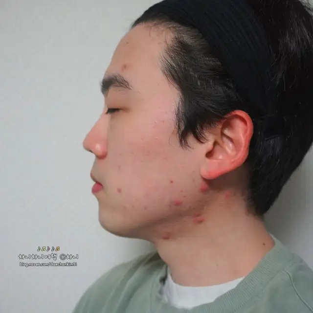 온제뷰티 사진 8
