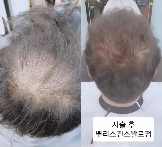 딘남성헤어 사진 2