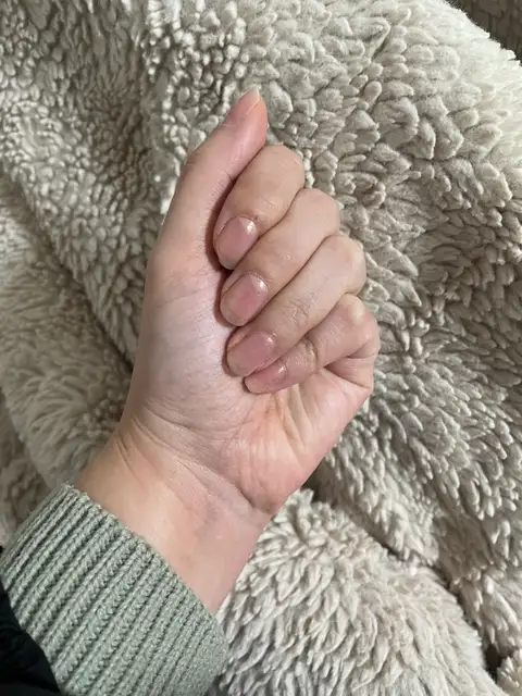 예쁘다그손 사진 2