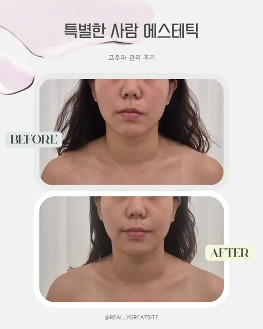 특별한사람 에스테틱 동탄역점 사진 3