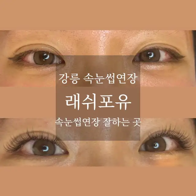 래쉬포유 사진 5