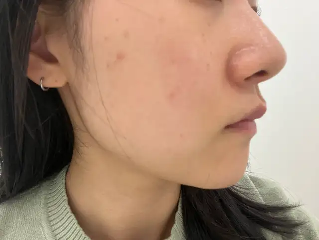 이소에스테틱 사진 8