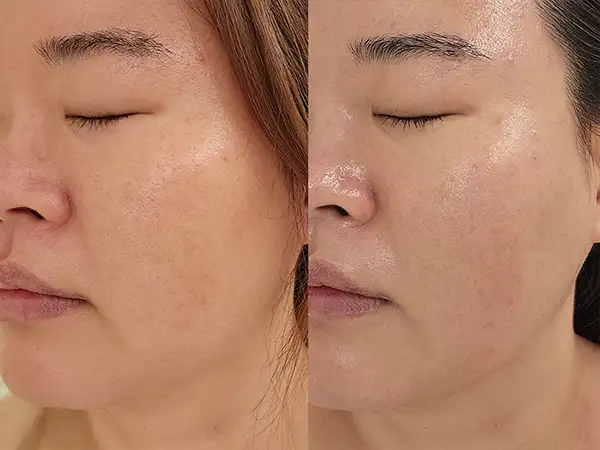 프롬미 송도점 사진 7