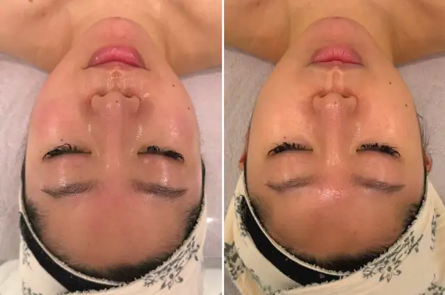 루비나피부&바디 사진 5