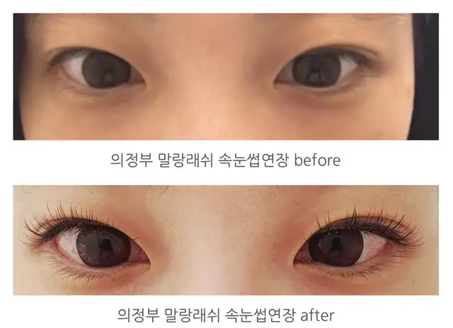 말랑래쉬 사진 7