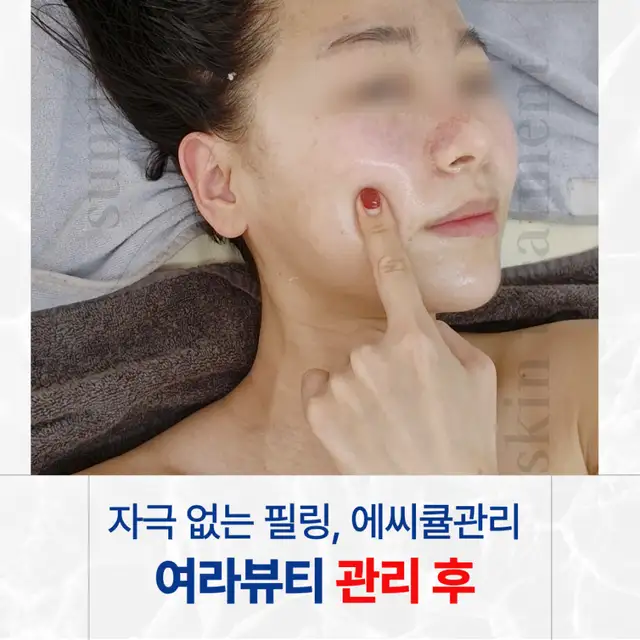 여라뷰티 사진 4