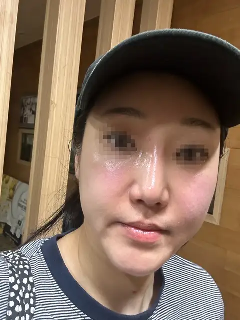 정은영스킨케어 사진 3