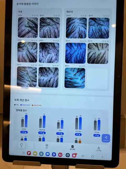 모스테틱 사진 2