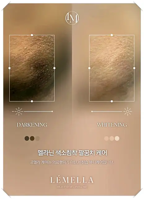 카라케어 사진 8