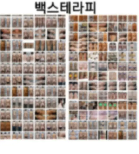 백스테라피 사진 8