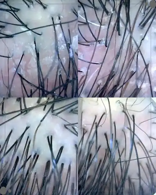 모스테틱 사진 4