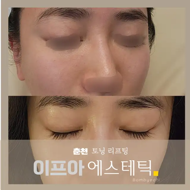 이프아에스테틱 사진 7