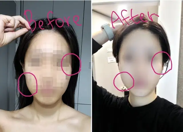 나티니럭스 에스테틱 사진 5