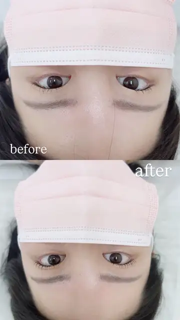 오르브로우 사진 7
